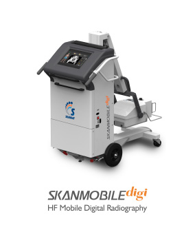 SkanMobile Digi