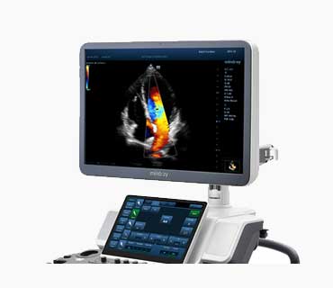 Ultrasound